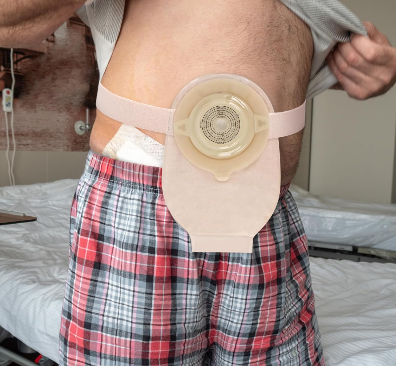 ADJUSTABLE OSTOMY APPLIANCE SUPPORT BELT 10 PCS